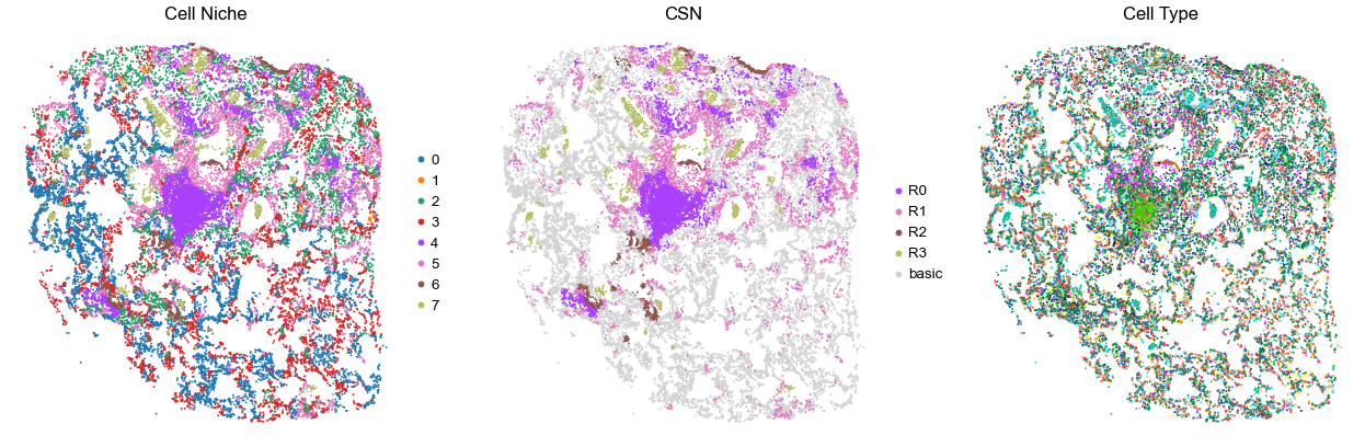 ../../_images/Case-control_studies_2.1_Xenium_PF_Vannan2025_runHarmonics_34_1.png