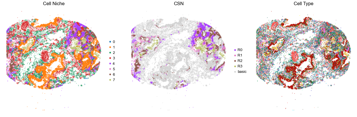 ../../_images/Case-control_studies_2.1_Xenium_PF_Vannan2025_runHarmonics_34_21.png