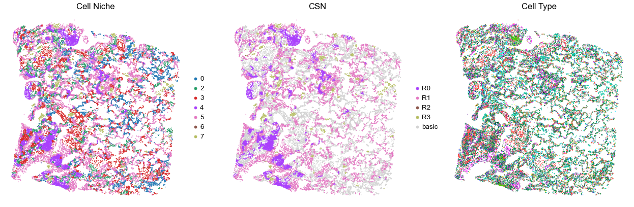 ../../_images/Case-control_studies_2.1_Xenium_PF_Vannan2025_runHarmonics_34_55.png