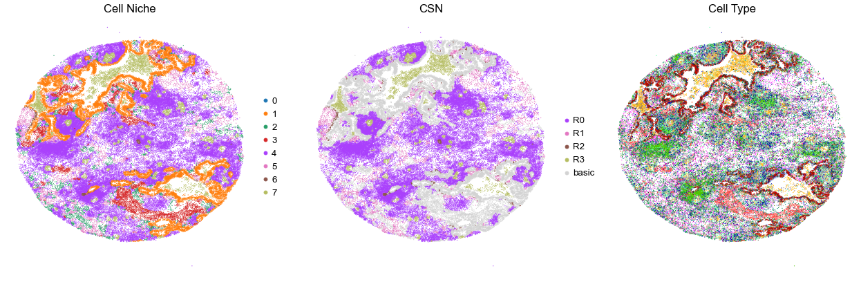 ../../_images/Case-control_studies_2.1_Xenium_PF_Vannan2025_runHarmonics_34_69.png