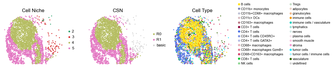 ../../_images/Case-control_studies_2.3_CODEX_CRC_Schurch2020_runHarmonics_34_25.png
