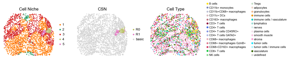 ../../_images/Case-control_studies_2.3_CODEX_CRC_Schurch2020_runHarmonics_34_43.png